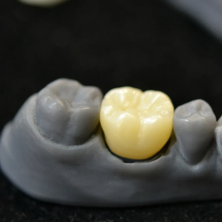 Printare 3D, obiecte custom, scanare 3D, print 3D arhitectura, tehnica dentara, mulaje, machete, modele